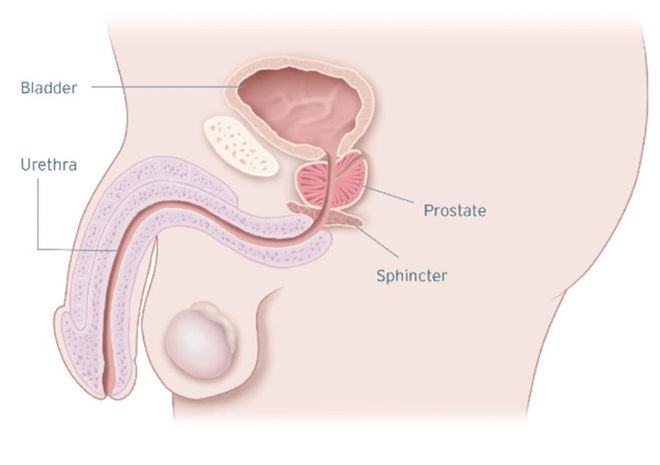 Stress Urinary Incontinence